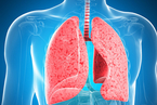 科研：慢阻肺患者猛增 中国近亿人患病