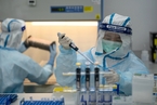 香港核酸检测公司在美上市 疫情后期如何拓展业务？