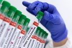 癌症患者疫苗保护或更快减弱 非洲疾控警告猴痘疫苗囤积｜大流行手记（5月26日）
