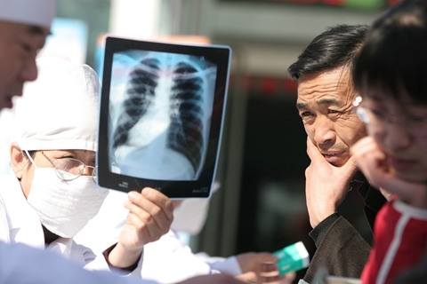 中疾控发文为全国肺结核患者画像 发病率最高是西藏