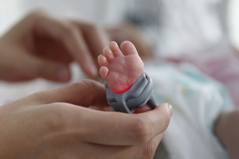 中国早产儿分娩量全球第二 新生儿健康监护未到位