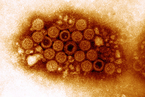 研究：无包膜病毒在微塑料表面可具传染性3天
