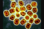 研究人员发现猴痘病毒正突变 影响暂未可知