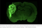 用人类干细胞培养的“类人脑”嵌入幼鼠大脑六个月之后｜新知录