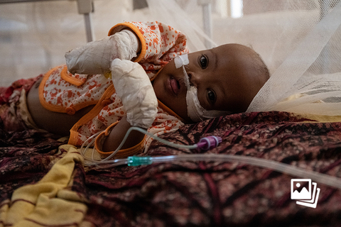 当地时间2022年11月9日，索马里拜多阿，严重营养不良的索马里婴儿在海湾地区医院的重症监护室等待治疗性喂养。联合国儿童基金会当地时间10月18日发出警告称，索马里遭遇历史性的干旱，数千名严重营养不良的儿童面临死亡的风险，儿基会敦促捐助者加大对索马里的支持。儿基会发言人詹姆斯·埃尔德在日内瓦的新闻发布会上表示，如果不加大行动和投资，索马里的儿童死亡人数将达半个世纪以来的历史新高。图：Scott Peterson/视觉中国