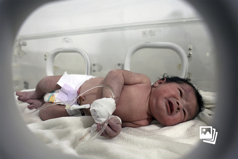 当地时间2023年2月7日，叙利亚阿勒颇省阿夫林，被从废墟中救出的婴儿在医院恒温箱内接受治疗，当被发现时，刚出生的的她脐带仍与母体相连。据了解，这名女婴是家庭中唯一的幸存者，她的父母和四个兄弟姐妹全部在这次地震中不幸遇难。6日，土耳其连续发生两次7.8级地震。截至目前，强震已造成土耳其和叙利亚两国超过1.2万人死亡。图：Rami al Sayed/视觉中国
