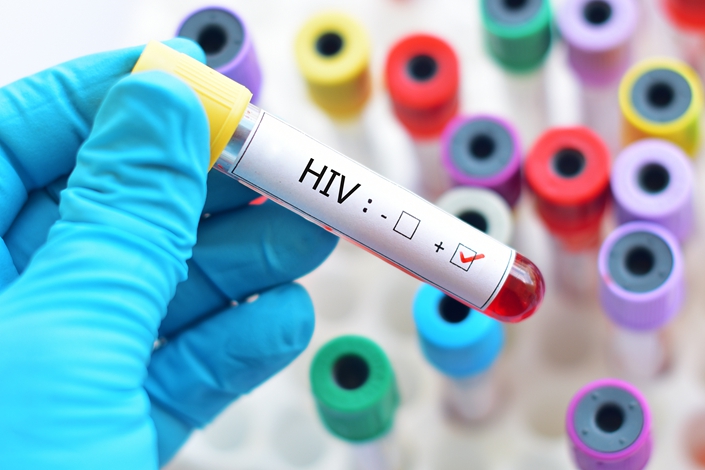 The tally of AIDS cases reported in China increased every year from 1985 to a peak of more than 150,000 in 2019, but then dropped by about 13% during the pandemic. Photo: VCG