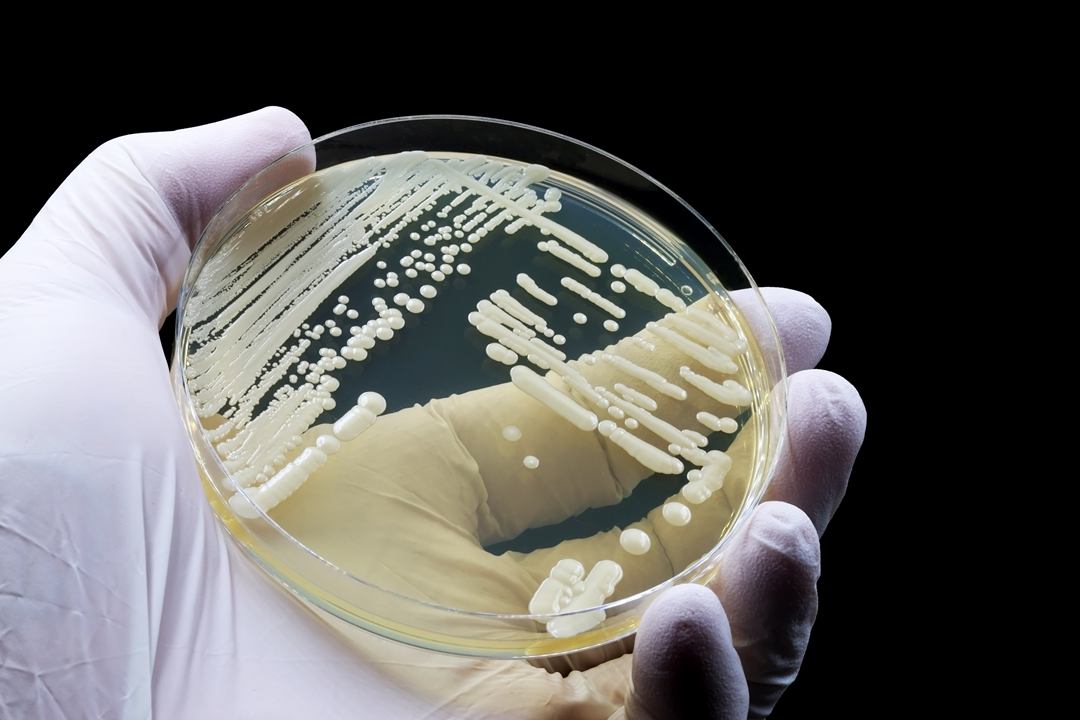 Candida auris is considered a “super fungus” known for its high drug resistance and mortality rate. Photo: VCG
