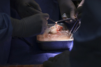 美科学家完成世界首例猪肾脏体内异种移植